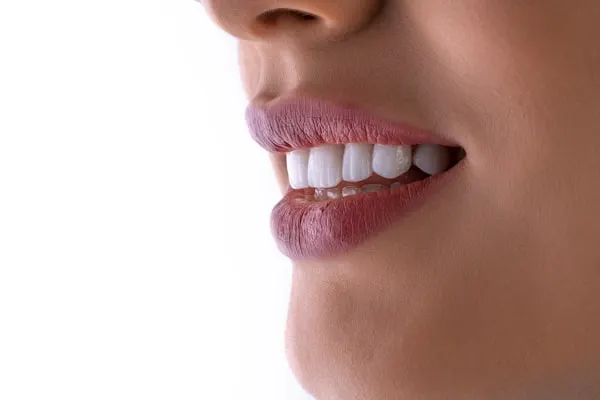 Blanqueamiento dental